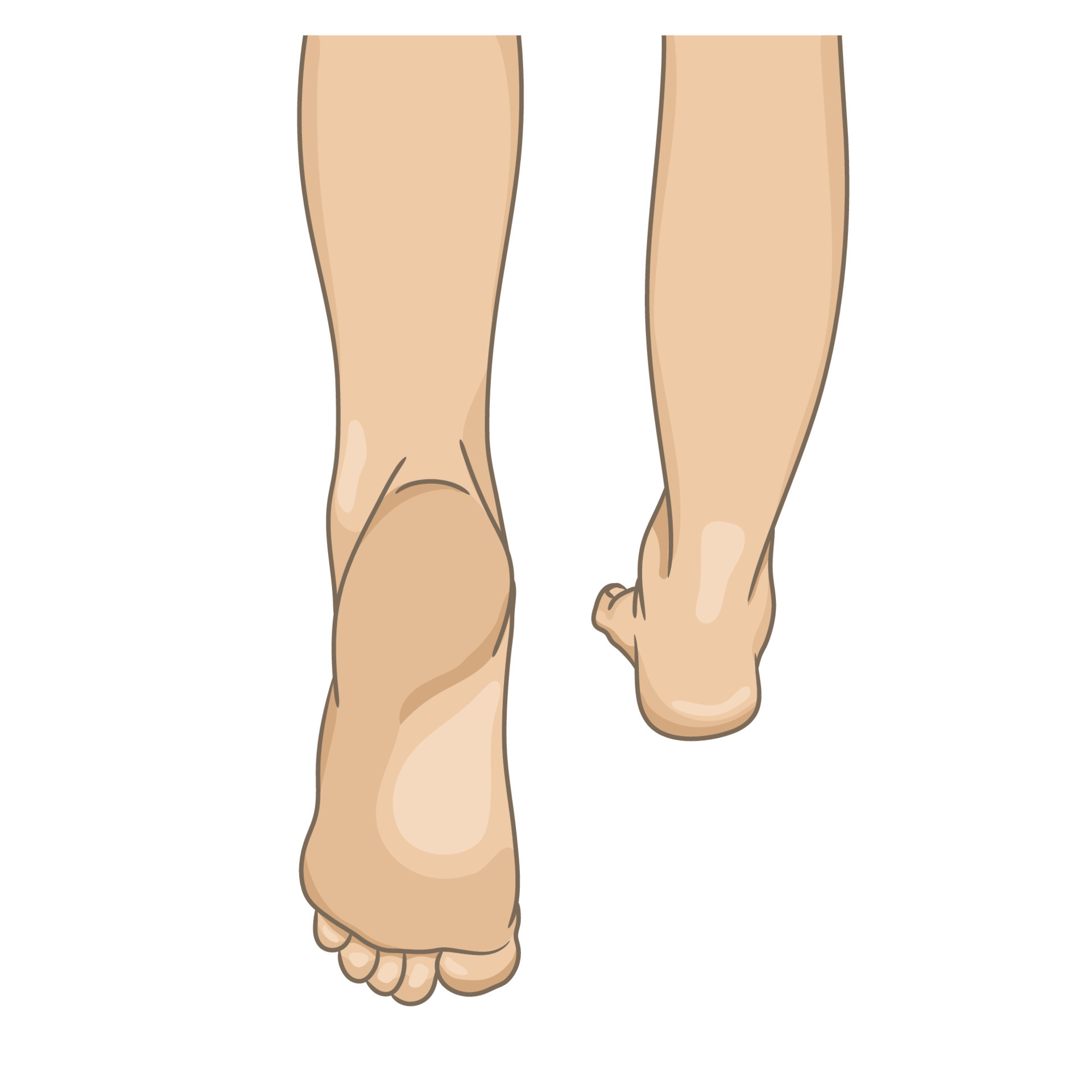 Toe Walks