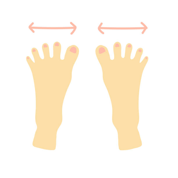 Toe Spreads